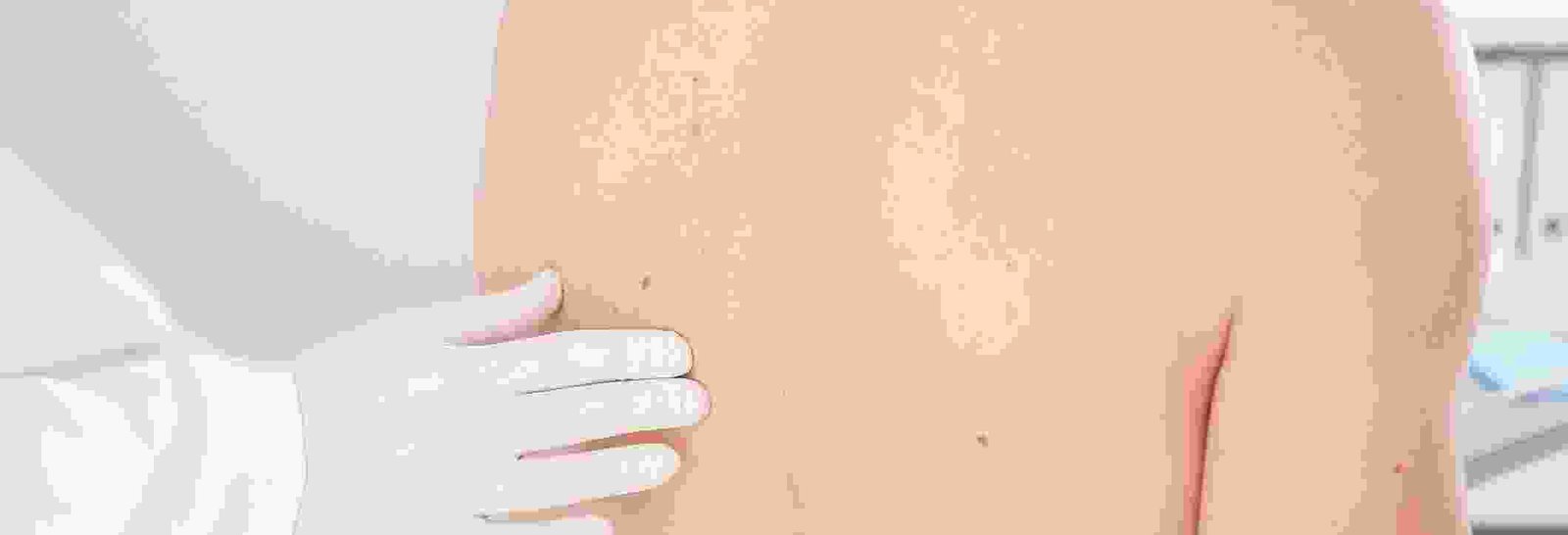 Derma Lux